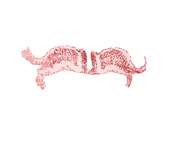 amniotic cavity, caudal neuropore, communication between primordial peritoneal cavity and extra-embryonic coelom, dorsal aorta plexus, umbilical vesicle cavity