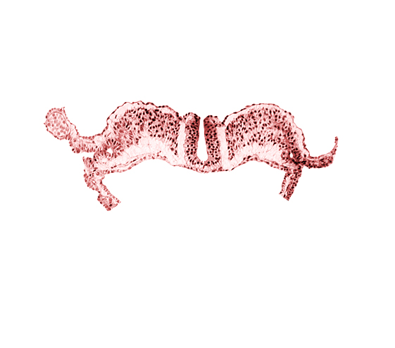 amniotic cavity, communication between primordial peritoneal cavity and extra-embryonic coelom, midgut, notochordal plate