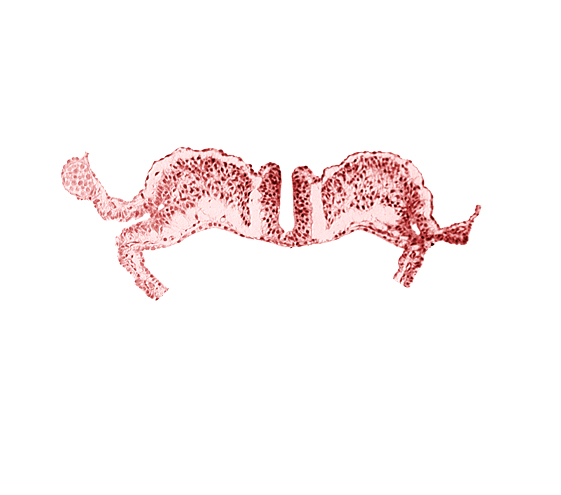 amniotic cavity, communication between primordial peritoneal cavity and extra-embryonic coelom, dorsal aorta plexus, midgut, notochordal plate