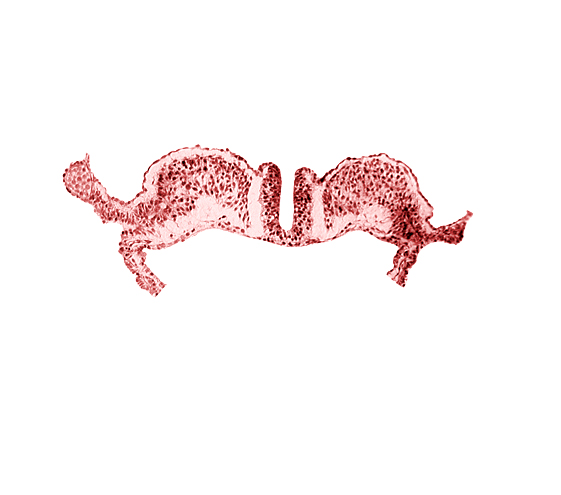 dorsal aorta plexus, notochordal plate, surface ectoderm