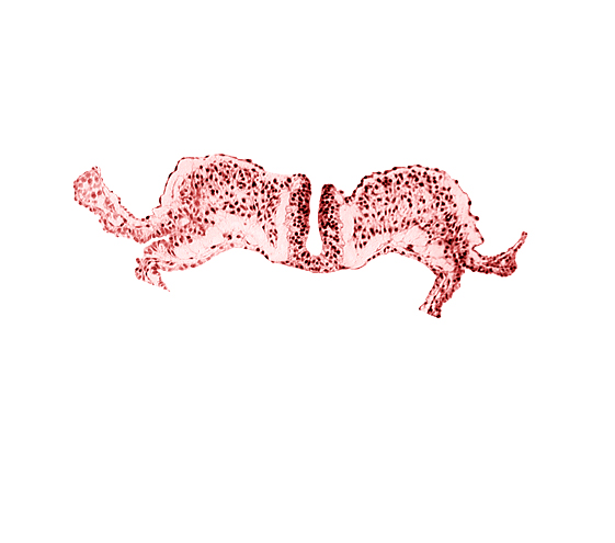 endoderm, neural fold, notochordal plate, primordial lateral body fold, surface ectoderm