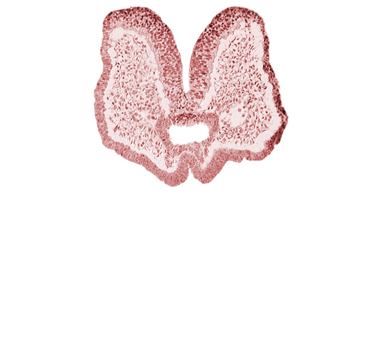 aortic arch 1, artifact space(s), cephalic neuropore, cephalic part of foregut, mandibular prominence of pharyngeal arch 1, mesencephalic neural crest, neural fold [mesencephalon (M)], neural groove (postoptic recess), notochordal plate, prechordal plate (oropharyngeal membrane), region of mesencephalic (cephalic) flexure, stomodeum, surface ectoderm