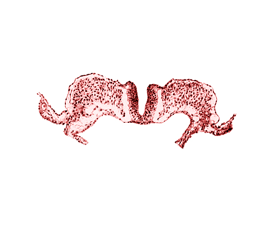 amnion attachment, amniotic cavity, midgut, primordial lateral body fold, umbilical vesicle cavity