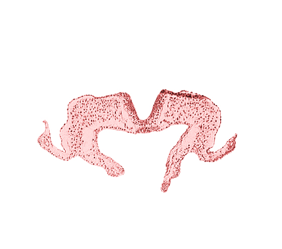 endoderm, mesoderm, midgut, neural fold, neural groove, notochordal plate, primordial lateral body fold, surface ectoderm