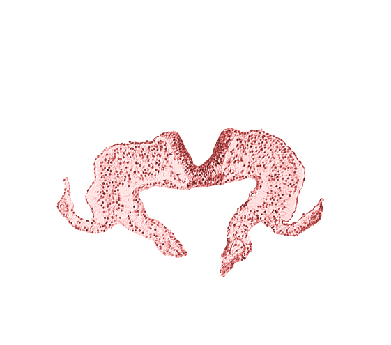 caudal edge of notochordal plate, mesoderm, midgut, neural fold, neural groove, primordial lateral body fold, surface ectoderm