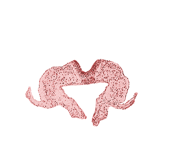 midgut, neural fold, neural groove, primordial lateral body fold, surface ectoderm