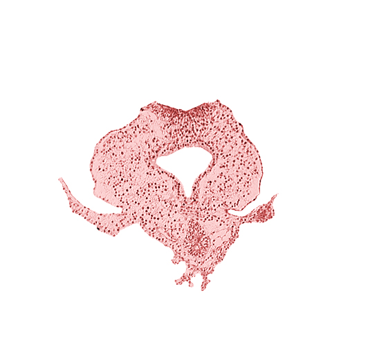 allantoic primordium, body stalk, gastrulation (primitive) streak, hindgut, neural plate, right umbilical vein, tail fold region