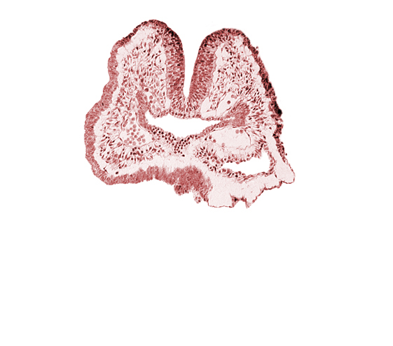 aortic arch 1, cephalic neuropore, dorsal aorta, endoderm, facio-vestibulocochlear neural crest (CN VII and CN VIII), floor of foregut, foregut, neural fold [rhombencephalon (Rh. A)], notochordal plate, pericardial cavity, pharyngeal pouch 1, surface ectoderm