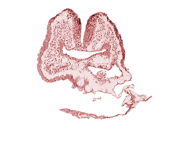 amnion, aortic arch 1, cephalic neuropore, dorsal aorta, endoderm, facio-vestibulocochlear neural crest (CN VII and CN VIII), floor of foregut, head fold region, neural fold [rhombencephalon (Rh. A)], pericardial cavity, pharyngeal pouch 1, surface ectoderm