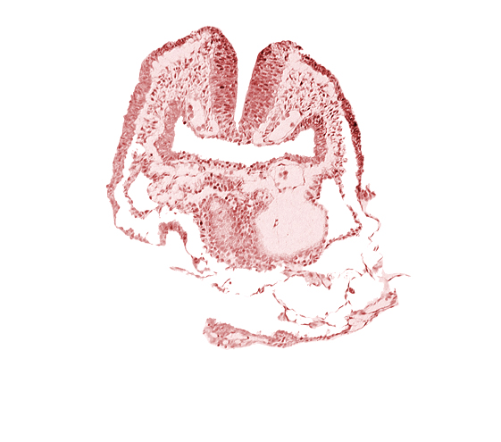 amnion, aortic arch 1, cephalic neuropore, dorsal aorta, facio-vestibulocochlear neural crest (CN VII and CN VIII), head fold region, neural fold [rhombencephalon (Rh. A)], pericardial cavity, pharyngeal pouch 1, pharyngeal pouch 1 endoderm: dorsal part, pharyngeal pouch 1 endoderm: ventral part