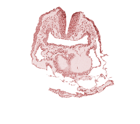 amnion, aortic arch 1, dorsal aorta, head fold region, neural fold [rhombencephalon (Rh. A)], pericardial cavity, pharyngeal pouch 1