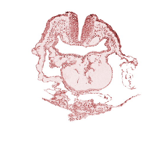 aortic arch 1, cephalic neuropore, conotruncus, dorsal aorta, head fold region, head mesenchyme, neural fold [rhombencephalon (Rh. A)], pericardial cavity, pharyngeal pouch 1, pharyngeal pouch 1 endoderm: dorsal part, pharyngeal pouch 1 endoderm: ventral part