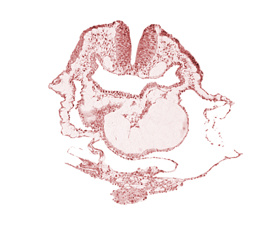 aortic arch 1, cardiac jelly, conotruncus, dorsal aorta, endocardium, head mesenchyme, junction of aortic arch 1 and primordial conotruncus, neural fold [rhombencephalon (Rh. A)], pericardial cavity