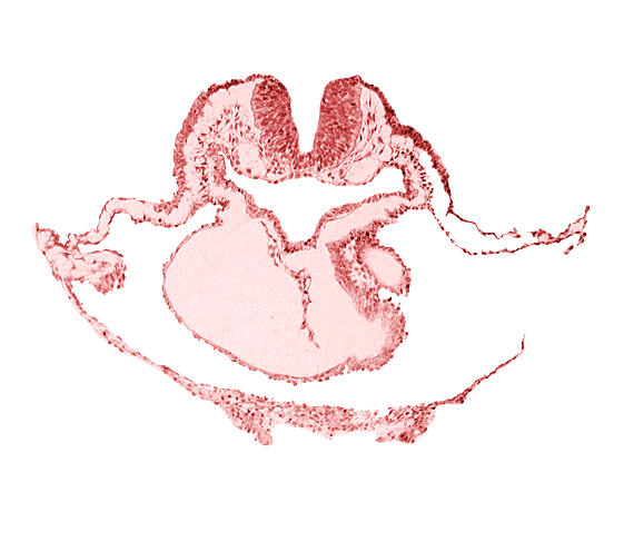 alar plate(s), artifact separation(s), basal plate, bulbis cordis, lateral pharyngeal recess, left bulboventricular sulcus, looped heart, neural fold [rhombencephalon (Rh. B)], notochordal plate, pericardial cavity, presumptive left ventricle, presumptive right ventricle, sulcus limitans