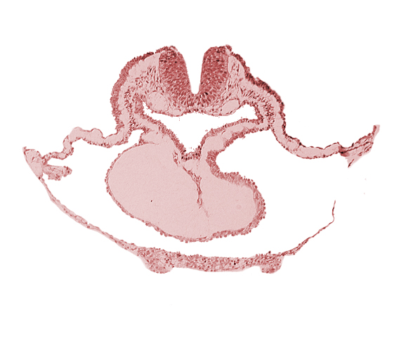artifact separation(s), cardiac jelly, cephalic neuropore, dorsal aorta, lateral pharyngeal recess, neural fold [rhombencephalon (Rh. B)], pericardial cavity, presumptive left ventricle