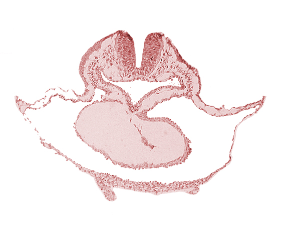 bulbis cordis, cardiac jelly, cephalic neuropore, dorsal aorta, lateral pharyngeal recess, median pharyngeal groove, neural fold [rhombencephalon (Rh. B)], pericardial cavity, presumptive left ventricle