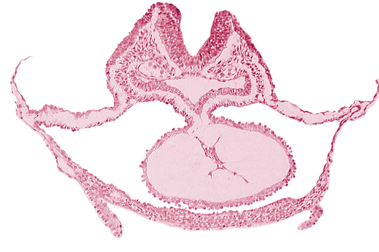 cardiac jelly, dorsal aorta, laryngotracheal sulcus, mesocardium, neural fold [rhombencephalon (Rh. C)], otic placode, pericardial cavity, presumptive left ventricle, respiratory primordium