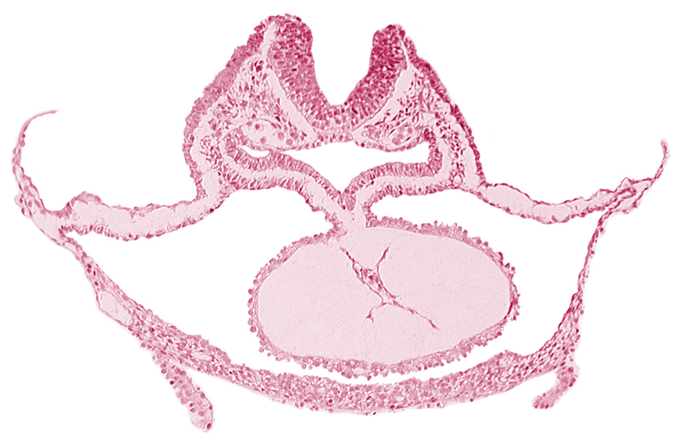 head mesenchyme, laryngotracheal sulcus, mesocardium, neural fold [rhombencephalon (Rh. C)], otic placode, pericardial cavity, presumptive left ventricle, respiratory primordium