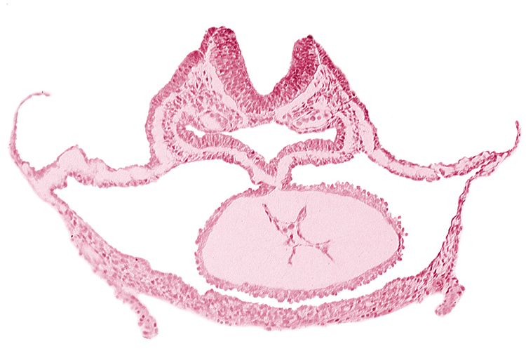foregut endoderm, foregut lumen, laryngotracheal sulcus, neural fold [rhombencephalon (Rh. C)], otic placode, presumptive left ventricle, respiratory primordium