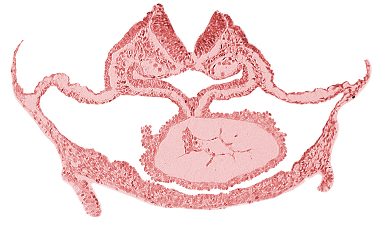 artifact separation(s), cardiac jelly, cephalic neuropore, dorsal aorta, foregut lumen, laryngotracheal sulcus, mesocardium, neural fold [rhombencephalon (Rh. C)], otic placode, presumptive left ventricle, primordial atrioventricular junction, respiratory primordium