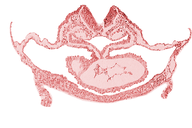 artifact separation(s), atrial canal, cephalic neuropore, dorsal aorta, foregut endoderm, foregut lumen, otic placode, presumptive left ventricle