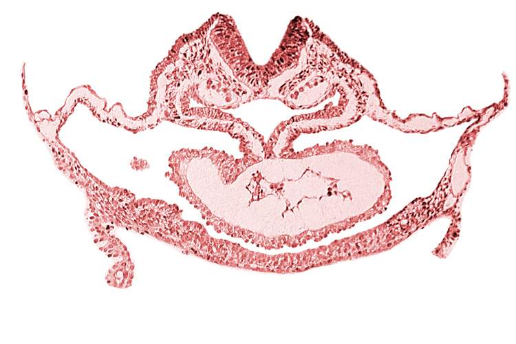 atrial canal, cardiac jelly, cephalic neuropore, dorsal aorta, edge of presumptive left atrium, foregut endoderm, foregut lumen, neural fold [rhombencephalon (Rh. C)], otic placode, pericardial cavity, presumptive left ventricle