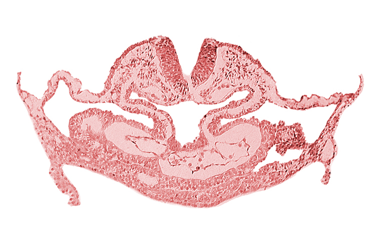amnion attachment, atrial canal, caudal edge of otic placode, dorsal aorta, hepatic plate, neural fold [rhombencephalon (Rh. C)], presumptive left atrium, presumptive right atrium