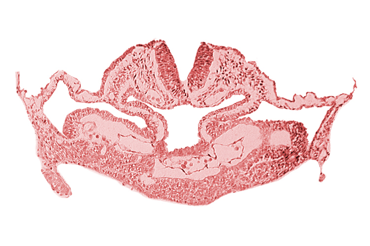 amnion attachment, atrial canal, cephalic neuropore, foregut, hepatic plate, neural fold [rhombencephalon (Rh. C)], presumptive left atrium, presumptive right atrium, primordial pericardioperitoneal canal (pleural cavity), septum transversum, surface ectoderm