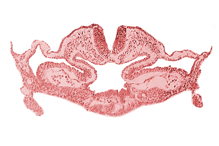 alar plate(s), basal plate, cephalic intestinal portal, dorsal aorta, head mesenchyme, hepatic plate / septum transversum region, neural fold [rhombencephalon (Rh. C)], notochordal plate, presumptive left atrium, presumptive right atrium, primordial pericardioperitoneal canal (pleural cavity), sulcus limitans