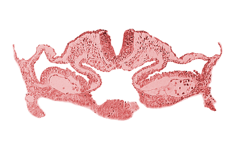 alar plate(s), basal plate, cephalic intestinal portal, dorsal aorta, head mesenchyme, hepatic plate / septum transversum region, neural fold [rhombencephalon (Rh. C)], notochordal plate, presumptive left atrium, presumptive right atrium, primordial pericardioperitoneal canal (pleural cavity), sulcus limitans