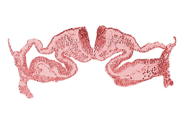 amnion attachment, amniotic cavity, artifact separation(s), midgut, presumptive right atrium, primordial pericardioperitoneal canal (pleural cavity), surface ectoderm, umbilical vesicle cavity