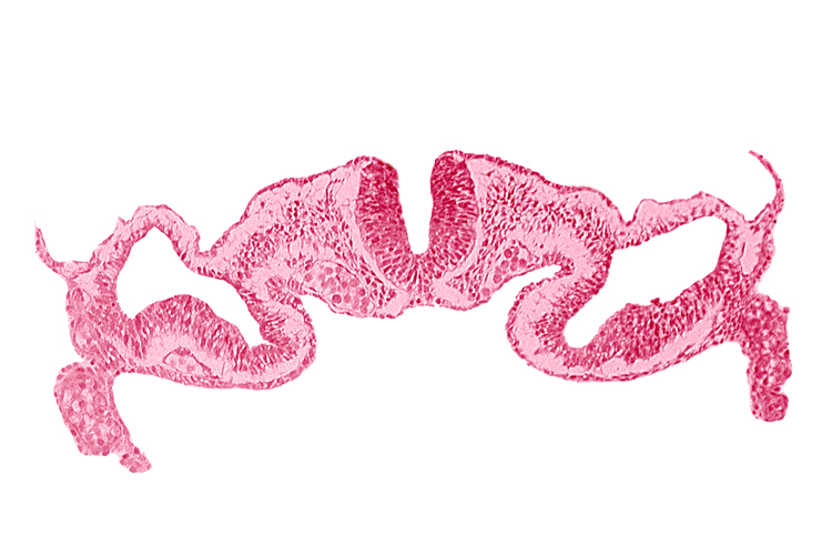 midgut, presumptive right atrium, primordial peritoneal cavity, surface ectoderm, umbilical vesicle cavity