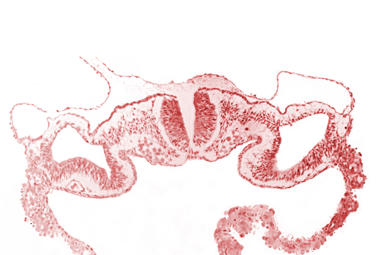 cephalic neuropore, dorsal aorta, midgut, presumptive right atrium, primordial peritoneal cavity, somatopleure, surface ectoderm, umbilical vesicle cavity