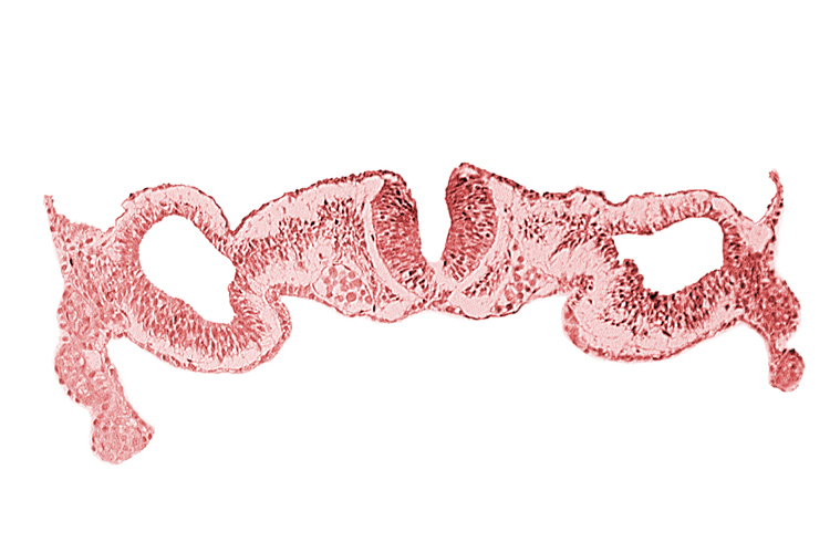 amnion attachment, dorsal aorta, dorsal intersegmental artery, midgut, neural fold [rhombencephalon (Rh. C)], primordial peritoneal cavity, sulcus limitans, surface ectoderm, umbilical vesicle wall