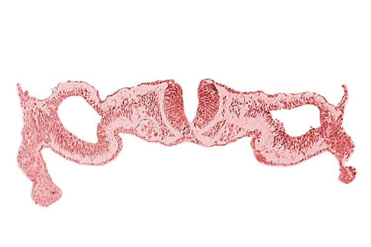 amnion attachment, artifact separation(s), cephalic edge of somite 1 (O-1), dorsal aorta, junction of neural ectoderm and surface ectoderm, junction of neural fold and surface ectoderm, midgut, neural fold [rhombencephalon (Rh. D)], primordial peritoneal cavity, umbilical vesicle wall