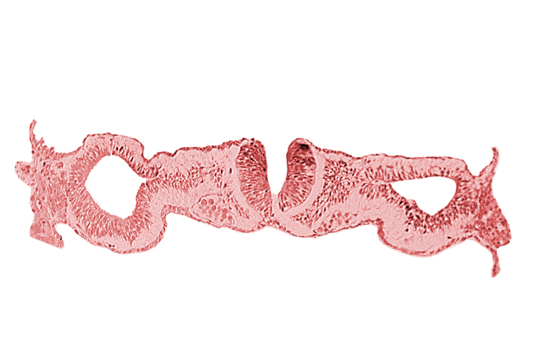 cephalic neuropore, dorsal aorta, intermediate mesenchyme, notochordal plate, primordial peritoneal cavity, sclerotomal cells, somatopleuric mesoderm, somite 1 (O-1), splanchnopleuric mesoderm