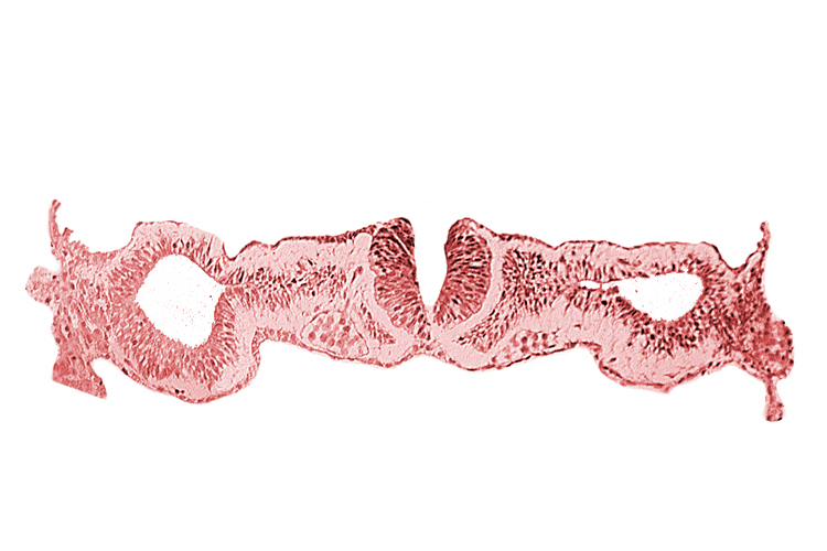 cephalic neuropore, dorsal aorta, intermediate mesenchyme, notochordal plate, primordial peritoneal cavity, sclerotomal cells, somatopleuric mesoderm, somite 1 (O-1), splanchnopleuric mesoderm