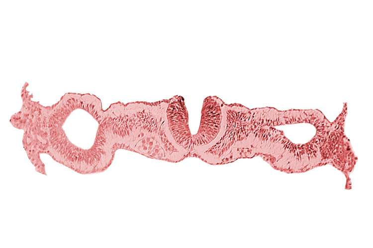 cephalic neuropore, dorsal aorta, intermediate mesenchyme, notochordal plate, primordial peritoneal cavity, sclerotomal cells, somatopleuric mesoderm, somite 1 (O-1), splanchnopleuric mesoderm