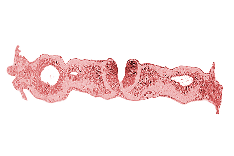 alar plate(s), basal plate, dorsal aorta, notochordal plate, primordial peritoneal cavity, somitocoel 1, sulcus limitans