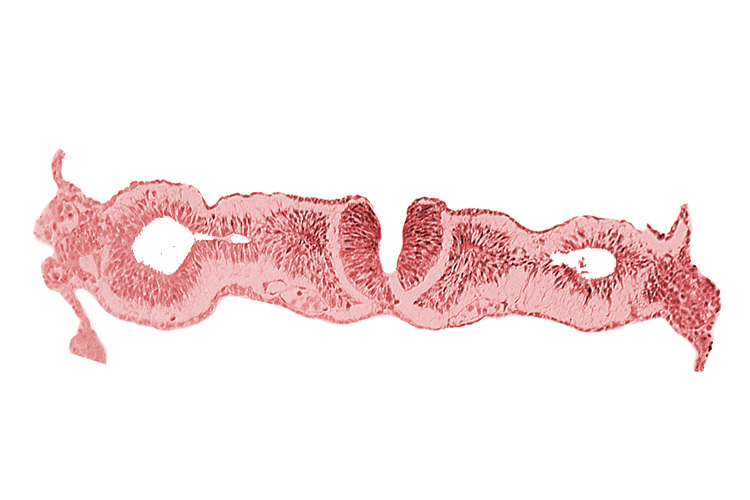 artifact separation(s), dorsal aorta, midgut, neural fold [rhombencephalon (Rh. D)], primordial peritoneal cavity, somite 1 (O-1)