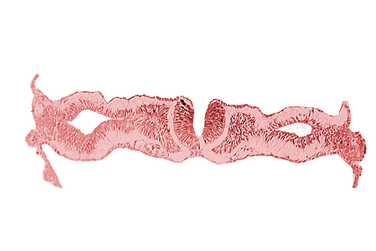 artifact separation(s), cephalic neuropore, dorsal aorta, primordial peritoneal cavity, somite 1 (O-1)