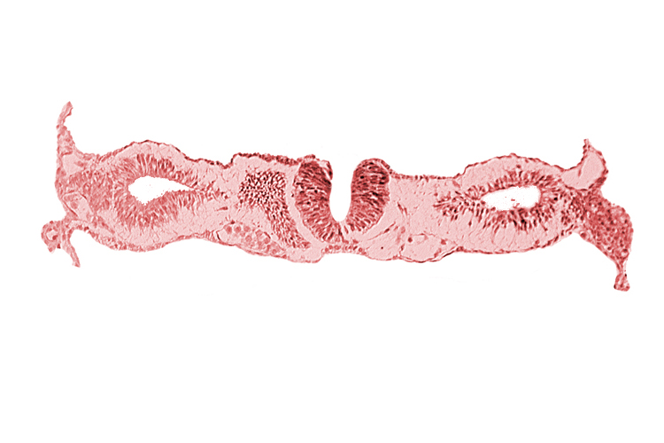 artifact separation(s), dorsal aorta, neural fold [rhombencephalon (Rh. D)], primordial peritoneal cavity, right umbilical vein, somite 1-2 intersegmental region