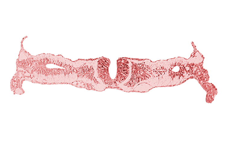 dorsal aorta, midgut, nephrogenic cord, neural fold [rhombencephalon (Rh. D)], primordial peritoneal cavity, right umbilical vein, somitocoel 2