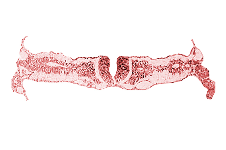 dorsal aorta, midgut, nephrogenic cord, neural fold [rhombencephalon (Rh. D)], primordial peritoneal cavity, right umbilical vein, somitocoel 2