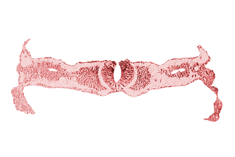 amnion, caudal edge of cephalic neuropore, neural fold [rhombencephalon (Rh. D)], notochordal plate, primordial peritoneal cavity, right umbilical vein, somite 2 (O-2), umbilical vesicle wall