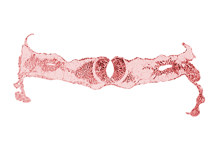amnion, junction area of neural folds [rhombencephalon (Rh. D)], midgut, notochordal plate, primordial peritoneal cavity, somite 2-3 intersegmental region