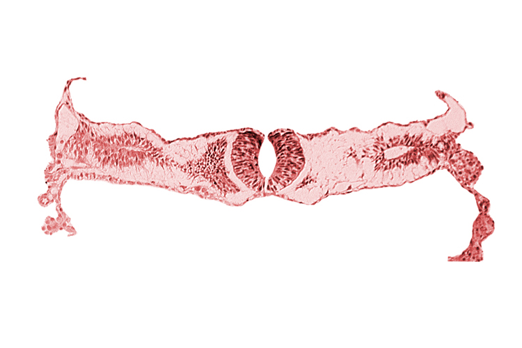 junction area of neural folds [rhombencephalon (Rh. D)], notochordal plate, primordial peritoneal cavity, somite 2-3 intersegmental region