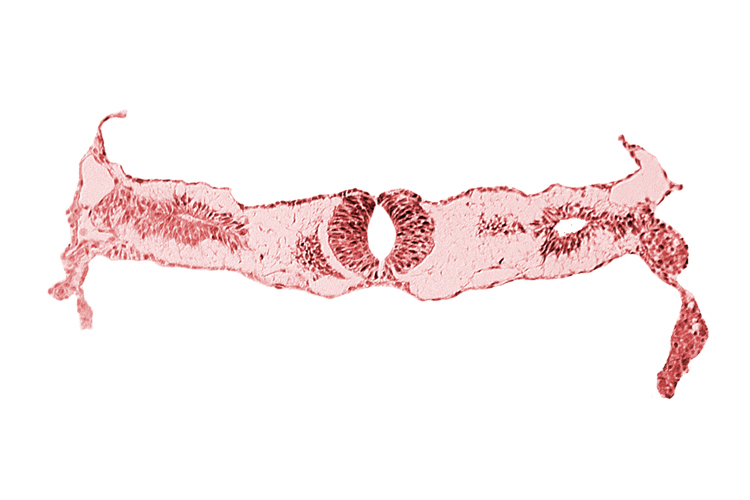 cephalic edge of neural tube, cephalic edge of somite 3 (O-3), fusing neural folds [rhombencephalon (Rh. D)], midgut, primordial peritoneal cavity, surface ectoderm