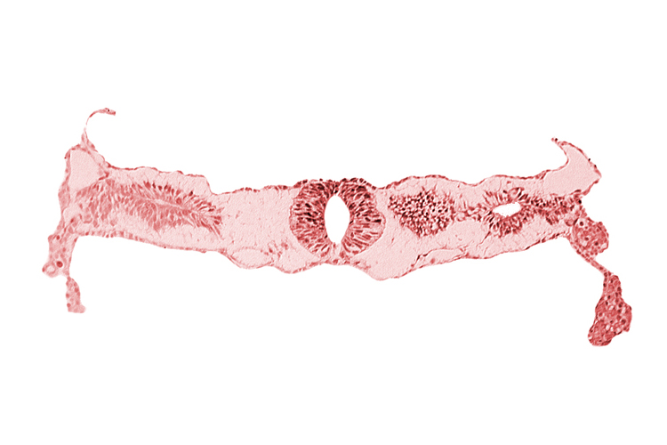 cephalic edge of neural tube, cephalic edge of somite 3 (O-3), fusing neural folds [rhombencephalon (Rh. D)], midgut, primordial peritoneal cavity, surface ectoderm