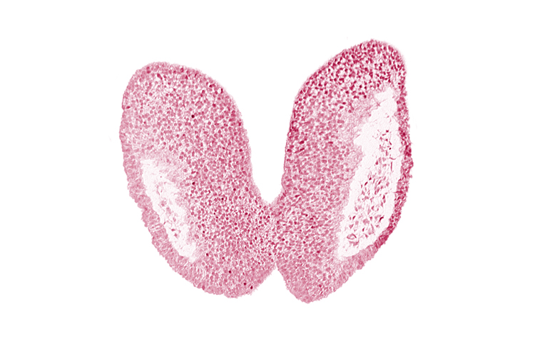 artifact space(s), cephalic neuropore, head mesenchyme, neural fold [primordial diencephalon (D1)], neural fold [primordial diencephalon (D2)], neural groove floor, optic sulcus [primordial diencephalon (D1)]